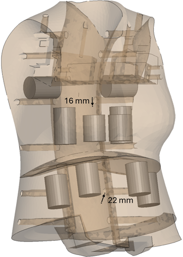 X-ray of abdomen and chest of SET F50